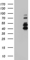 HEK293T cells were transfected with the pCMV6-ENTRY control (Left lane) or pCMV6-ENTRY IRAK2 (Right lane) cDNA for 48 hrs and lysed. Equivalent amounts of cell lysates (5 ug per lane) were separated by SDS-PAGE and immunoblotted with anti-IRAK2.