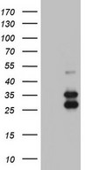 HEK293T cells were transfected with the pCMV6-ENTRY control (Left lane) or pCMV6-ENTRY IRAK2 (Right lane) cDNA for 48 hrs and lysed. Equivalent amounts of cell lysates (5 ug per lane) were separated by SDS-PAGE and immunoblotted with anti-IRAK2.