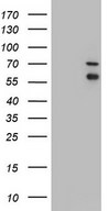 HEK293T cells were transfected with the pCMV6-ENTRY control (Left lane) or pCMV6-ENTRY IRAK2 (Right lane) cDNA for 48 hrs and lysed. Equivalent amounts of cell lysates (5 ug per lane) were separated by SDS-PAGE and immunoblotted with anti-IRAK2.