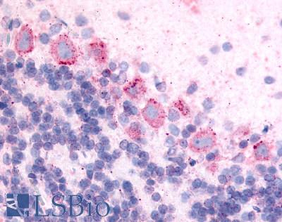 Anti-GPR89A antibody LS-A1732 IHC of rat brain, Purkinje neurons. Immunohistochemistry of formalin-fixed, paraffin-embedded tissue after heat-induced antigen retrieval.