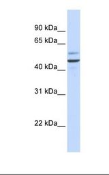 Fetal brain lysate. Antibody concentration: 1.0 ug/ml. Gel concentration: 12%.