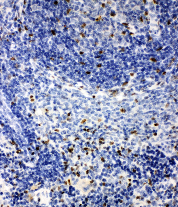 IRAK2 / IRAK-2 antibody. IHC(P): Rat Spleen Tissue.