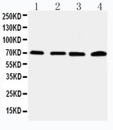 WB of IRAK2 / IRAK-2 antibody. Lane 1: 22RV Cell Lysate. Lane 2: A549 Cell Lysate. Lane 3: PANC Cell Lysate. Lane 4: SMMC Cell Lysate.