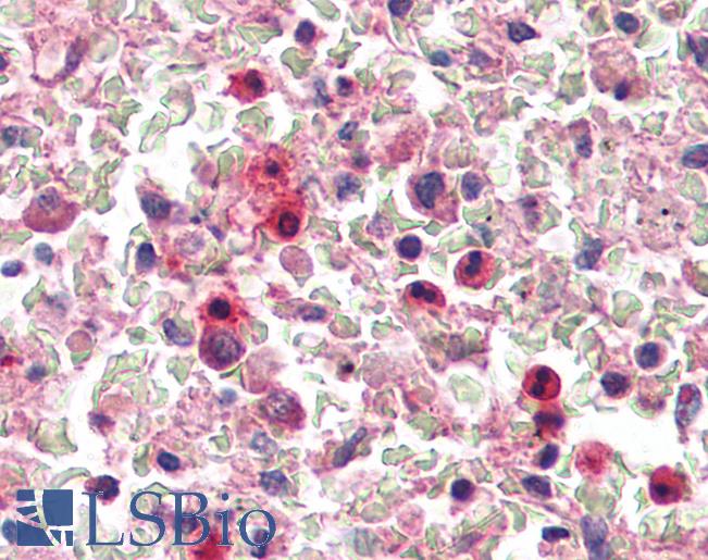 Anti-IRAK2 antibody IHC of human spleen. Immunohistochemistry of formalin-fixed, paraffin-embedded tissue after heat-induced antigen retrieval. Antibody LS-B3188 concentration 5 ug/ml.