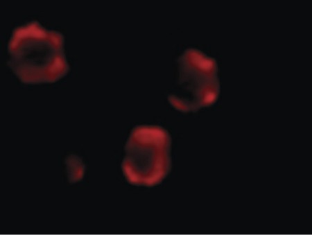 Immunofluorescence of IRAK-2 in HeLa cells with IRAK-2 antibody at 10 ug/ml.