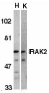 Western blot of IRAK2 in HeLa (H) and K562 (K) whole cell lysate with IRAK2 antibody at 2 ug/ml.