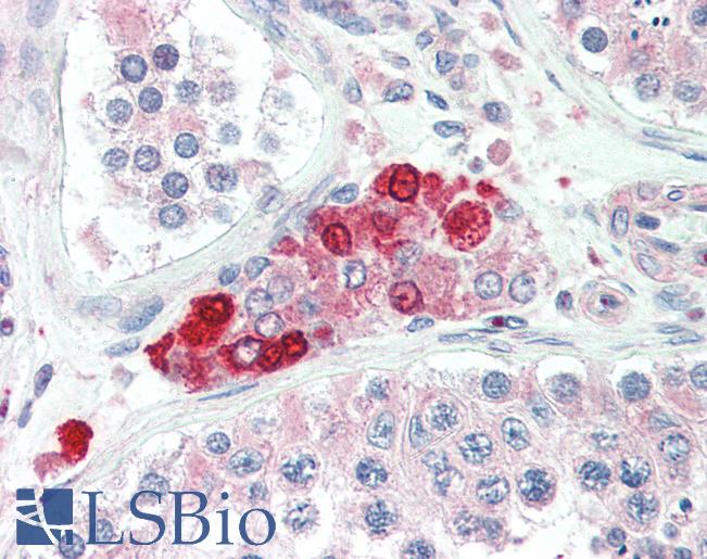 Anti-IRAK2 antibody IHC of human testis. Immunohistochemistry of formalin-fixed, paraffin-embedded tissue after heat-induced antigen retrieval. Antibody LS-B3201 concentration 5 ug/ml.