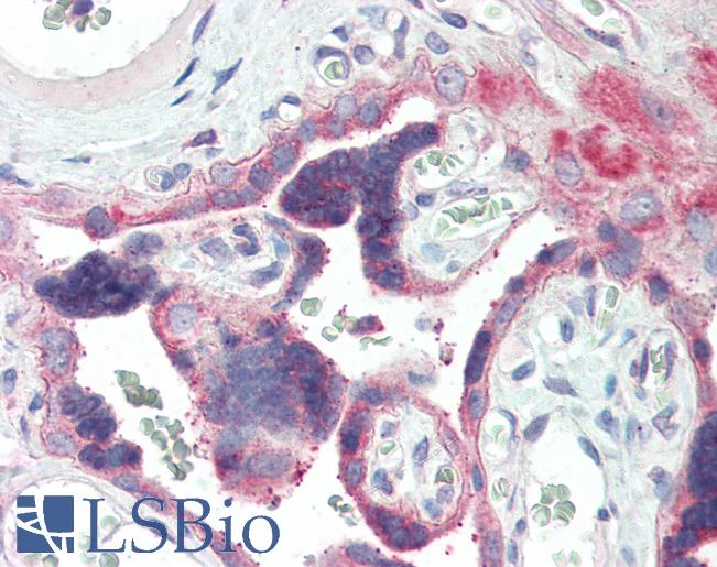 Anti-IRAK2 antibody IHC of human placenta. Immunohistochemistry of formalin-fixed, paraffin-embedded tissue after heat-induced antigen retrieval. Antibody LS-B3201 concentration 5 ug/ml.