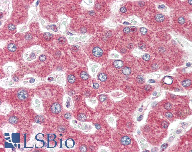 Anti-IRAK2 antibody IHC of human liver. Immunohistochemistry of formalin-fixed, paraffin-embedded tissue after heat-induced antigen retrieval. Antibody LS-B3201 concentration 5 ug/ml.