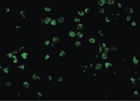 Immunofluorescence of IRAK2 in A20 cells with IRAK2 antibody at 10 ug/ml.