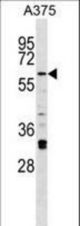 Mouse Irak2 Antibody western blot of A375 cell line lysates (35 ug/lane). The Irak2 antibody detected the Irak2 protein (arrow).