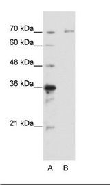 B: HepG2 Cell Lysate