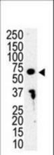 Western blot of anti-IRAK3 antibody in HL-60 cell lysate. IRAK3 (arrow) was detected using purified antibody. Secondary HRP-anti-rabbit was used for signal visualization with chemiluminescence.