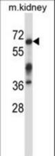 Mouse Irak3 Antibody western blot of mouse kidney tissue lysates (35 ug/lane). The Irak3 antibody detected the Irak3 protein (arrow).