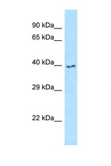 IRAK4 antibody LS-C145994 Western blot of MCF7 Cell lysate. Antibody concentration 1 ug/ml.