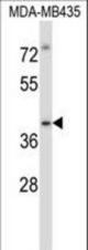 Mouse Irak4 Antibody western blot of MDA-MB435 cell line lysates (35 ug/lane). The Irak4 antibody detected the Irak4 protein (arrow).