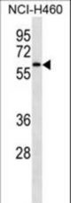 IRAK4 Antibody western blot of NCI-H460 cell line lysates (35 ug/lane). The IRAK4 antibody detected the IRAK4 protein (arrow).