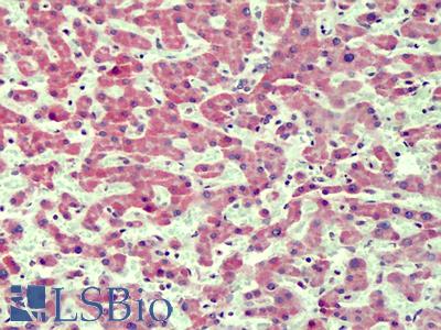 Anti-IRAK4 antibody IHC of human liver. Immunohistochemistry of formalin-fixed, paraffin-embedded tissue after heat-induced antigen retrieval. Antibody LS-B4823 concentration 3.75 ug/ml.
