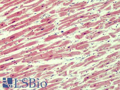 Anti-IRAK4 antibody IHC of human heart. Immunohistochemistry of formalin-fixed, paraffin-embedded tissue after heat-induced antigen retrieval. Antibody LS-B4823 concentration 3.75 ug/ml.