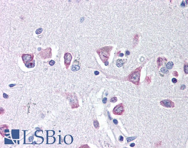 Anti-IREB2 antibody IHC of human brain. Immunohistochemistry of formalin-fixed, paraffin-embedded tissue after heat-induced antigen retrieval. Antibody LS-B48 concentration 20 ug/ml.