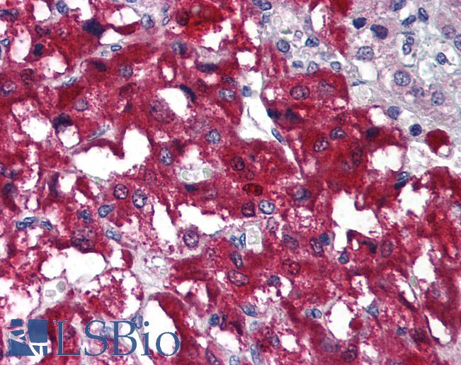 Anti-IREB2 antibody IHC of human adrenal medulla. Immunohistochemistry of formalin-fixed, paraffin-embedded tissue after heat-induced antigen retrieval. Antibody LS-B675 concentration 5 ug/ml.