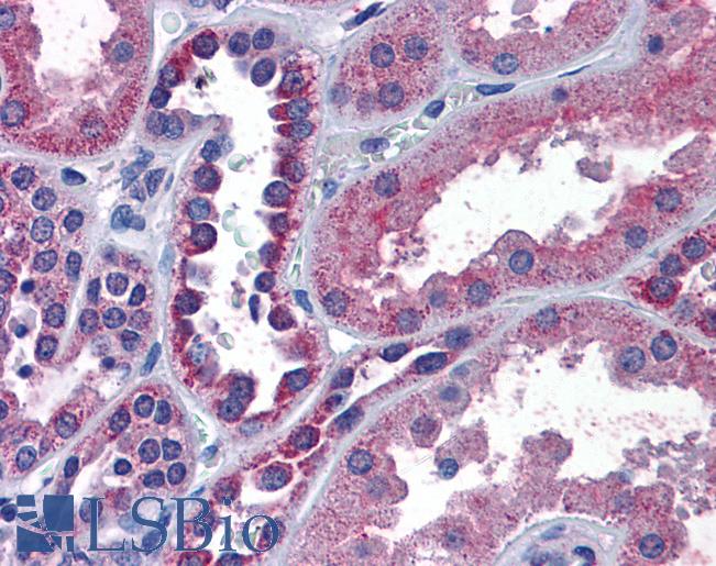 Anti-IREB2 antibody IHC of human kidney. Immunohistochemistry of formalin-fixed, paraffin-embedded tissue after heat-induced antigen retrieval. Antibody LS-B4397 concentration 3.75 ug/ml.