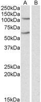 IREB2 antibody (0.3 ug/ml) staining of Human Liver lysate (35 ug protein in RIPA buffer). Primary incubation was 1 hour. Detected by chemiluminescence.