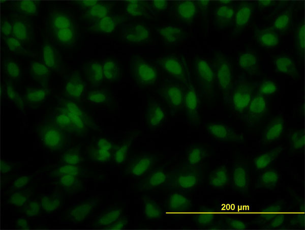 Immunofluorescence of monoclonal antibody to IRF2 on HeLa cell. [antibody concentration 10 ug/ml]