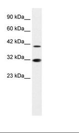 Jurkat Cell Lysate