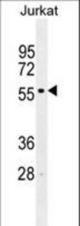 IRF2 Antibody western blot of Jurkat cell line lysates (35 ug/lane). The IRF2 antibody detected the IRF2 protein (arrow).