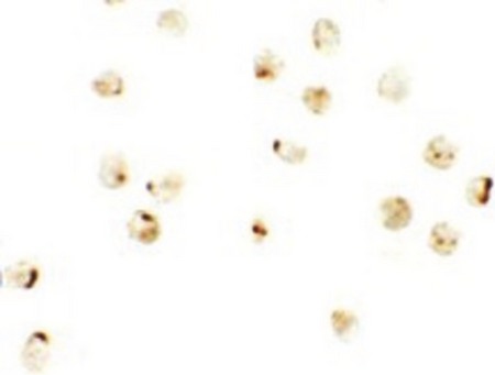 Immunocytochemistry of IRF2BP2 in A20 cells with IRF2BP2 antibody at 2.5 ug/ml.