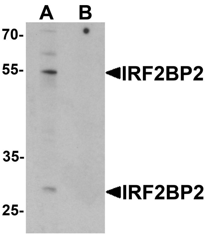 Western blot analysis of IRF2BP2 in HeLa cell lysate with IRF2BP2 antibody at 1 ug/ml in (A) the absence and (B) the presence of blocking peptide