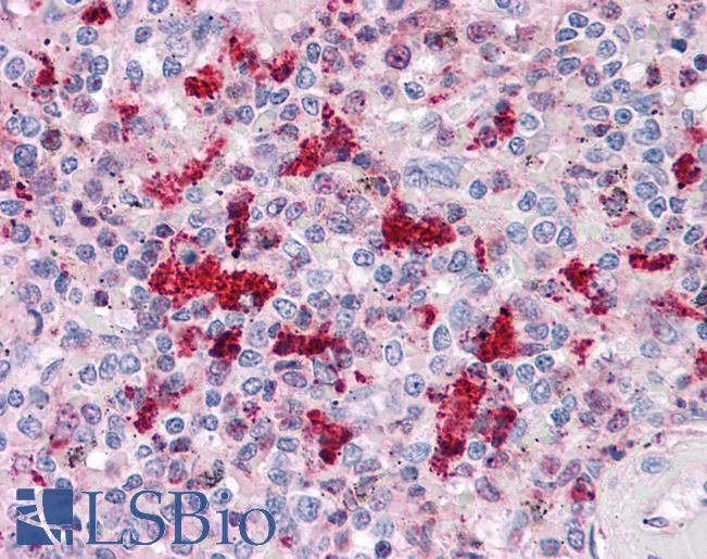 Anti-IRF2BP1 antibody IHC of human spleen. Immunohistochemistry of formalin-fixed, paraffin-embedded tissue after heat-induced antigen retrieval. Antibody LS-B4723 concentration 5 ug/ml.