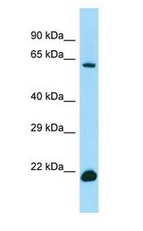 IRF2BP2 antibody Western Blot of 721_B.