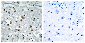 IHC of paraffin-embedded human brain tissue, using GASP1 Antibody. The picture on the right is treated with the synthesized peptide.