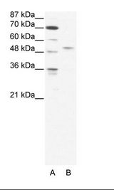 A: Marker, B: HepG2 Cell Lysate