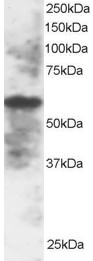 Staining (2 ug/ml) of A549 lysate (RIPA buffer, 30 ug total protein per lane). Primary incubated for 1 hour. Detected by chemiluminescence.