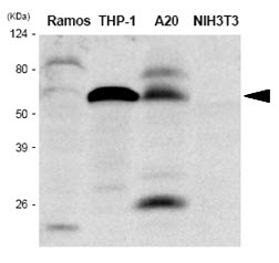 The extracts of Ramos, THP-1, A20 and NIH3T3 were resolved by SDS-PAGE, transferred to PVDF membrane and probed with anti-human IRF5antibody (1:1000). Proteins were visualized using a goat anti-mouse secondary antibody conjugated to HRP and an ECL detection system.