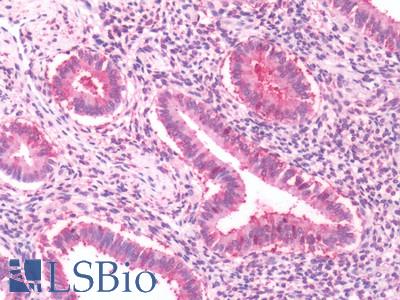 Human, Uterus: Formalin-Fixed Paraffin-Embedded (FFPE)