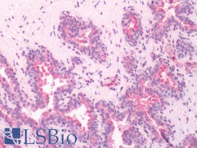 Human, Prostate: Formalin-Fixed Paraffin-Embedded (FFPE)