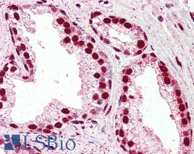 Anti-IRF6 antibody IHC of human prostate. Immunohistochemistry of formalin-fixed, paraffin-embedded tissue after heat-induced antigen retrieval. Antibody LS-B3231 concentration 5 ug/ml.