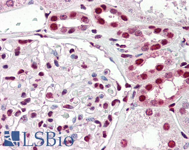 Anti-IRF6 antibody IHC of human kidney. Immunohistochemistry of formalin-fixed, paraffin-embedded tissue after heat-induced antigen retrieval. Antibody LS-B3231 concentration 5 ug/ml.