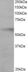 Antibody staining (0.2 ug/ml) of Human Ovary lysate (RIPA buffer, 35 ug total protein per lane). Primary incubated for 1 hour. Detected by Western blot of chemiluminescence.