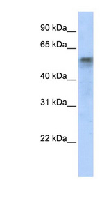 IRF6 antibody LS-C109695 Western blot of Transfected 293T cell lysate.