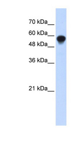 IRF6 antibody LS-C110313 Western blot of Transfected 293T cell lysate.