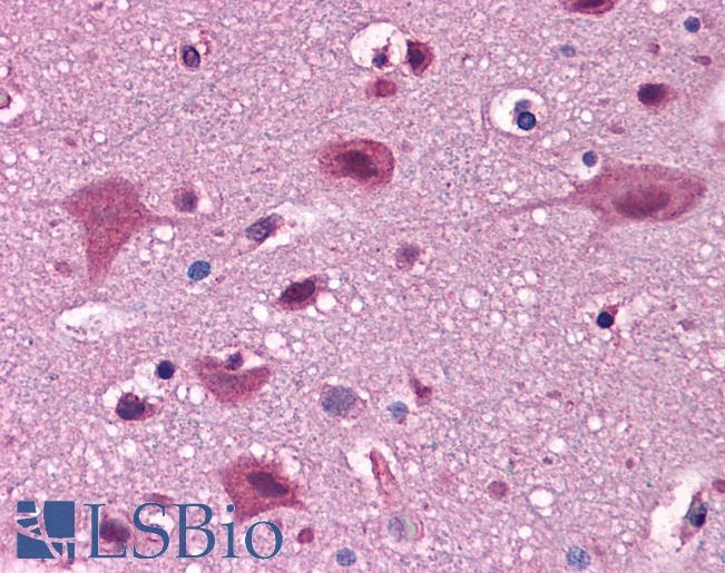Anti-IRGC antibody IHC of human brain, cortex. Immunohistochemistry of formalin-fixed, paraffin-embedded tissue after heat-induced antigen retrieval. Antibody LS-B5019 concentration 5 ug/ml.