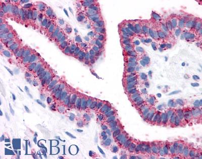 Anti-GPRC5A / RAI3 antibody LS-A3552 IHC of human breast. Immunohistochemistry of formalin-fixed, paraffin-embedded tissue after heat-induced antigen retrieval.