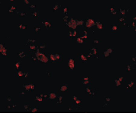 Immunofluorescence of IRGCa in A20 cells with IRGCa antibody at 20 ug/ml.