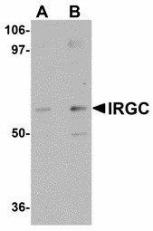 Western blot of IRGC in A20 cell lysate with IRGC antibody at (A) 1 and (B) 2 ug/ml.