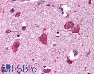 Anti-IRGC antibody IHC of human brain, cortex. Immunohistochemistry of formalin-fixed, paraffin-embedded tissue after heat-induced antigen retrieval. Antibody LS-B5020 concentration 5 ug/ml.